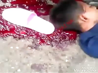 Teenager dies of a sneak attack