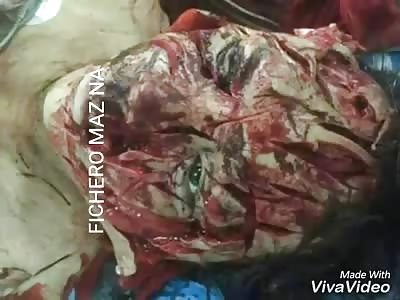 Photos of blood and guts are best enjoyed with music