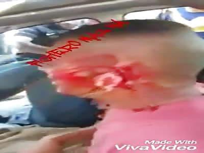 Loses ear in accident