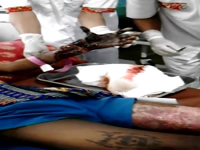 The dangers of abusing masturbation