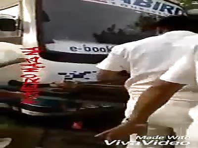 Truck crushed man's leg