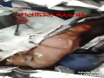 Fatal accident killed and injured in agony