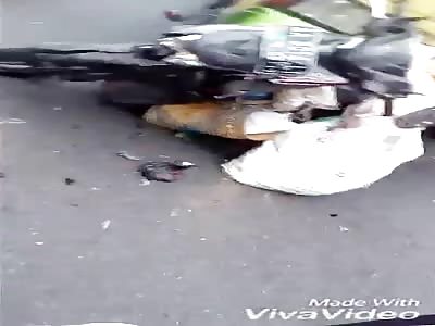 Woman with shattered leg