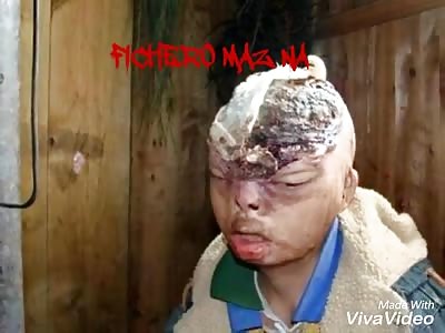 Man with a rotten head