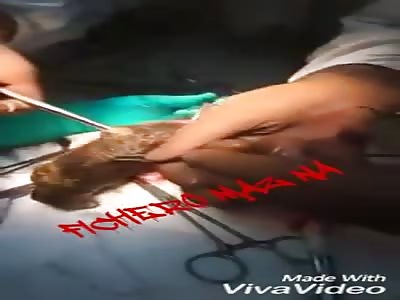 They take enormous amount of hair from the stomach