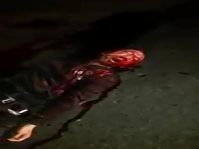 Man agonizes to Death, fucked up After bad Collision