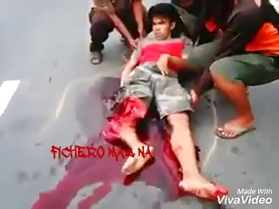 Painfull Terrible Leg Injury