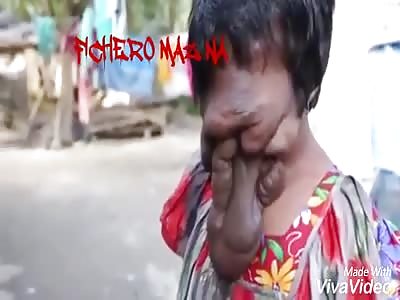 His face falls from shame