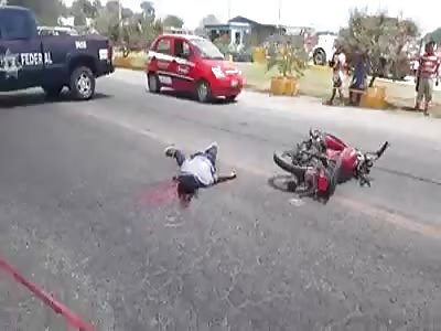 They stepped on his head