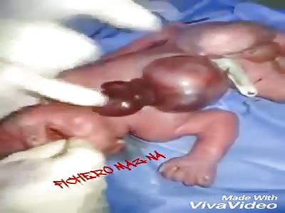 (Shocking) very sad the heart out of his body