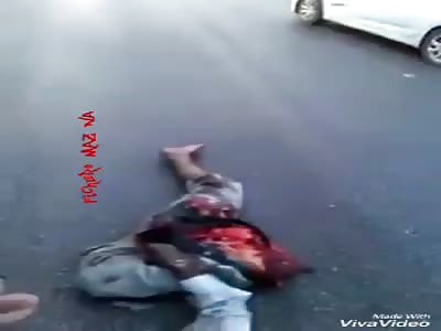 Man split in two in accident