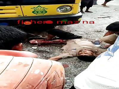 Man with shattered leg