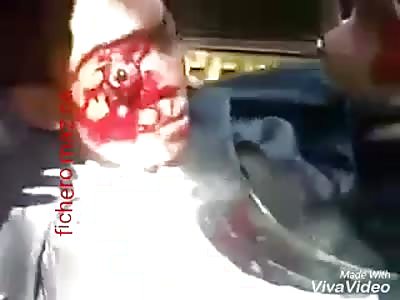 They crush him until he misses an eye