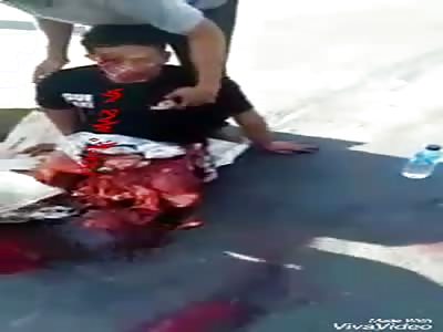 Man loses legs in accident