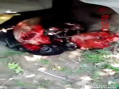 Man disfigured in accident