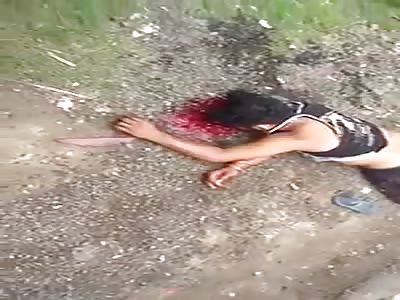 Accident  broken head