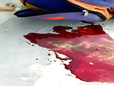 Aftermath of accident woman agonizing