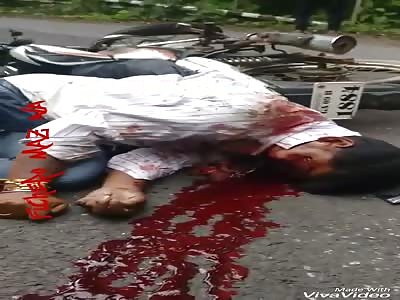 Man with totally shattered face