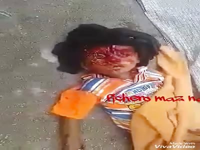 Mother and son with crushed head