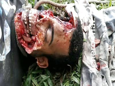 Man Found With Guts Out And Face Partially Eaten