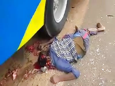 Man with crushed head