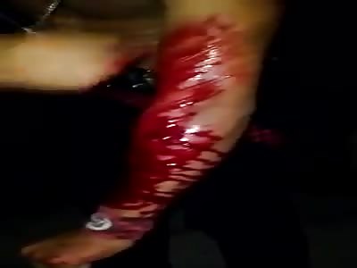 Attracting attention