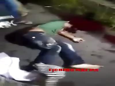 Man dies losing his arm and with his forehead open in accident