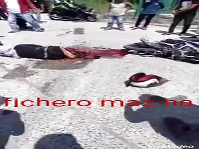 Woman loses her legs in motorcycle accident