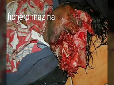 Man with shattered head and faceless