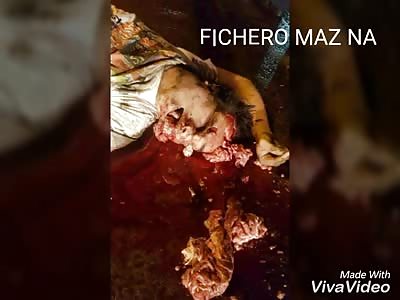 Woman with brain scattered on pavement