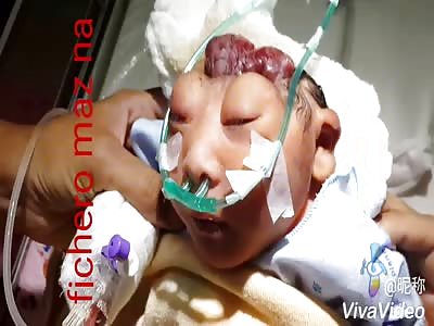 Shocking, deformed and brainless