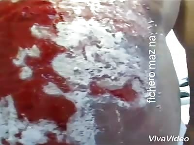 Man was burned with boiled water for wife