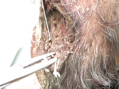 Worm nest on the head of man