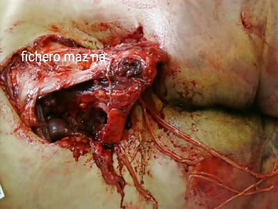 Man dies by accident leaving big wounds