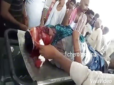 man dies in front of a crowd