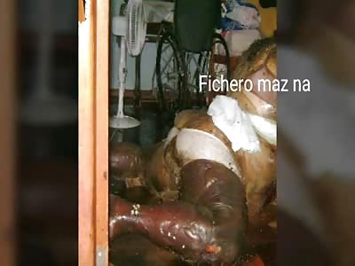 LACK OF LOVE: Obese woman kills herself with no one to love her