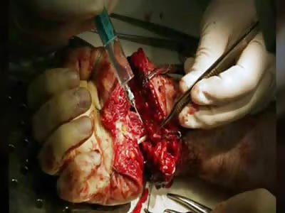 AWESOME: Replica Hand Jacket