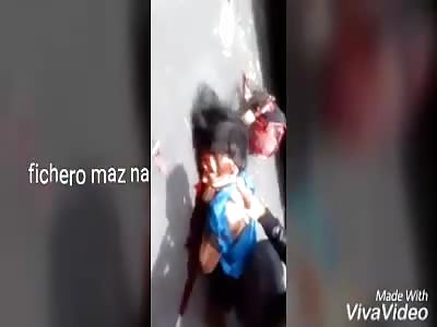 IMPRESSIVE: woman suffering an accident dies and dies at the scene