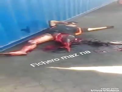 IMPRESSIVE: man loses left limb when suffering a work accident