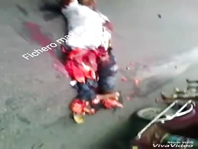 BRUTAL: This man loses his right leg when suffering an accident