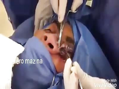 CONSUMPTION NECROSIS OF COCAINE