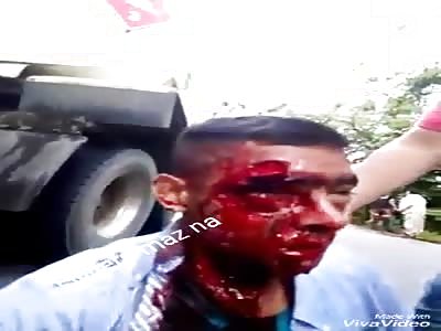 BRUTAL: motorcyclist suffers a terrible accident when being fanned by pipe