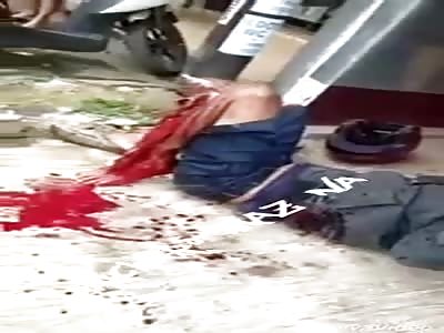 ACCIDENT: man loses foot after suffering an accident