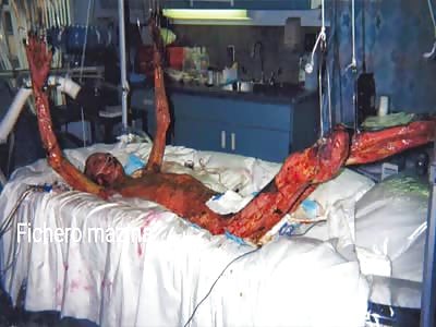 WTF: man dies because of his constant exposure to radiation at work