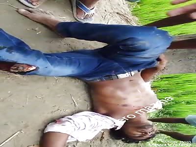 man with broken leg twists in pain