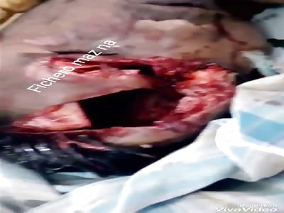 BRUTAL: man loses his life and remains with his head open