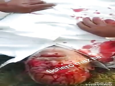 ACCIDENT: man sunbathing after suffering an accident