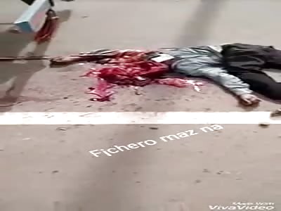 Totally brainless man