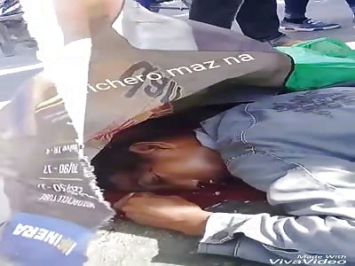 man with crushed head