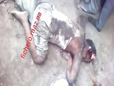 ACCIDENT: man dies with a broken head